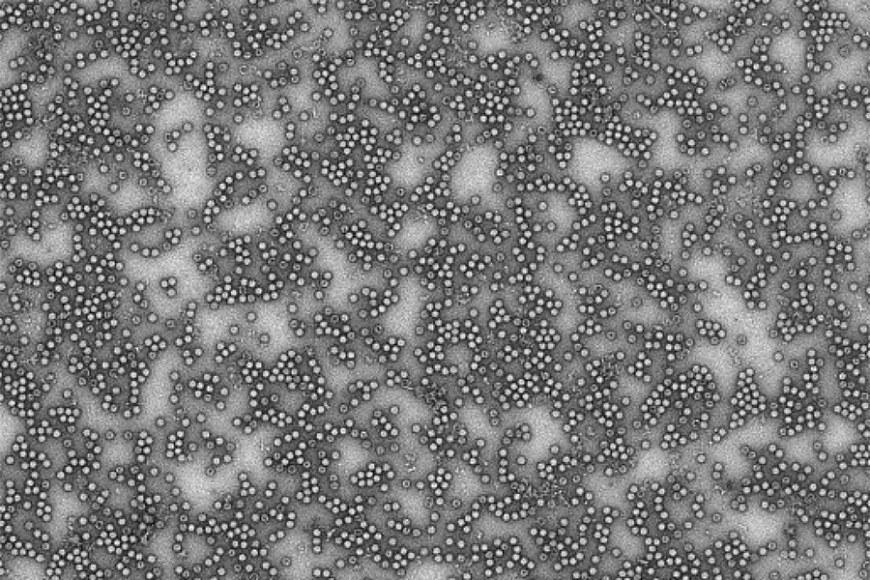 Coxsackie B viruksia elektronimikroskoopilla kuvattuna (kuva: Varpu Marjomäki, Jyväskylän yliopisto, ja Minna Hankaniemi, Tampereen yliopisto)