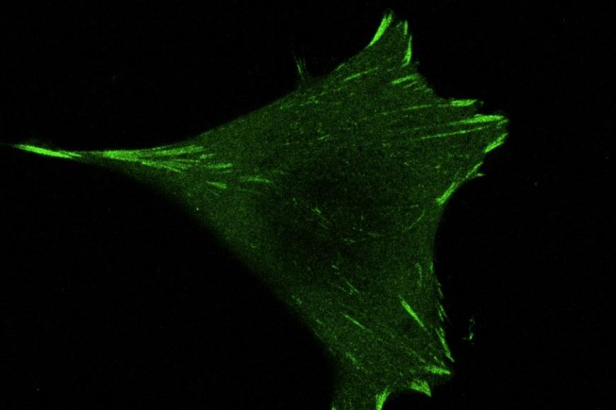 Through the action of paxillin, cells form focal adhesions (in green) to anchor themselves in their environment.