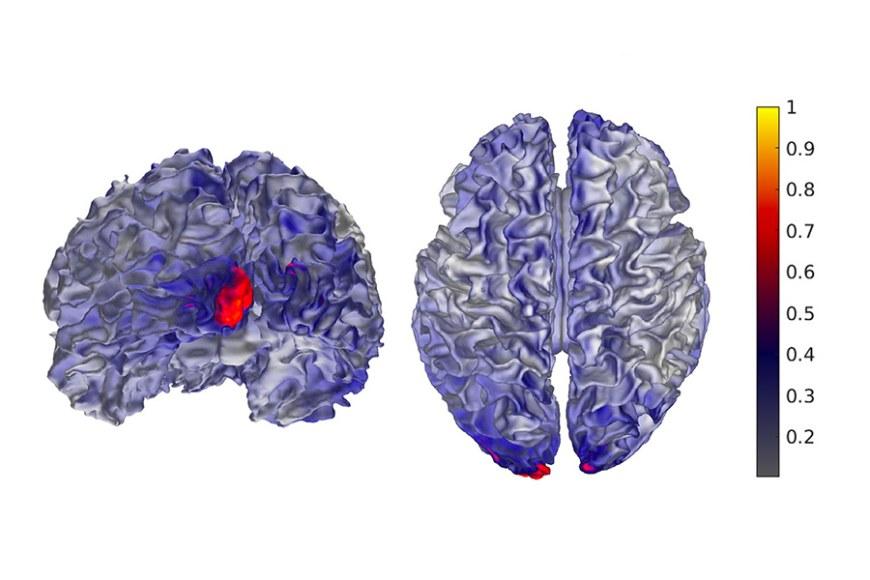 An optimized tES current pattern in brain
