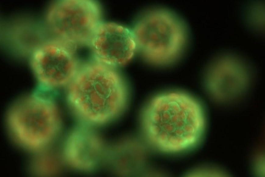Fluorescence-stained organoids.